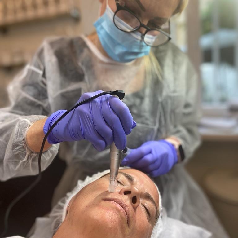 Microneedling-Behandlung im Kosmetikstudio Sibylle Maas
